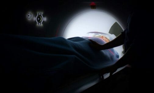 Inteligencia artificial para luchar contra el cáncer