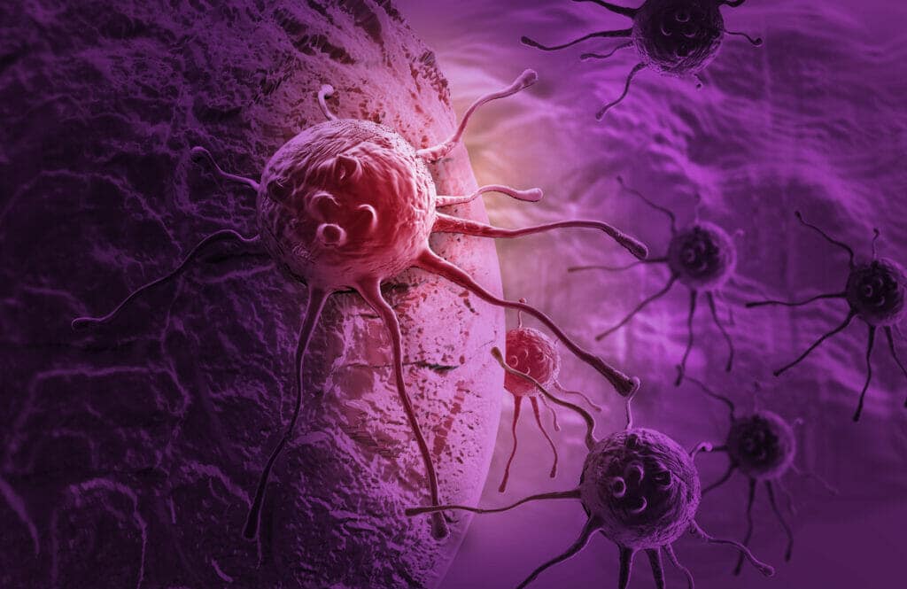 células de cáncer