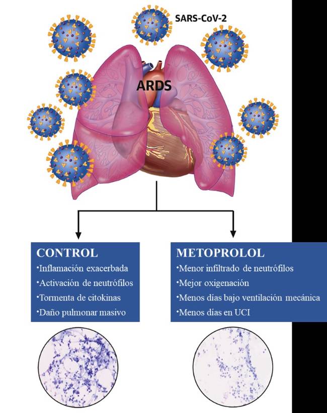 Metoprolol contra el Covid