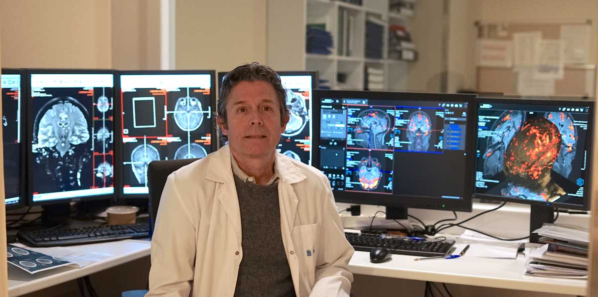 doctor-Juan-Álvarez-Linera-Prado,-neurorradiólogo-jefe-del-Servicio-de-Diagnóstico-por-Imagen-del-Hospital-Ruber-Internacional.