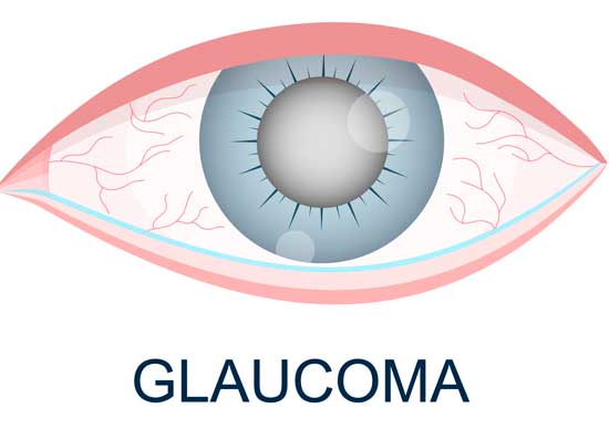 dia-mundial-del-glaucoma