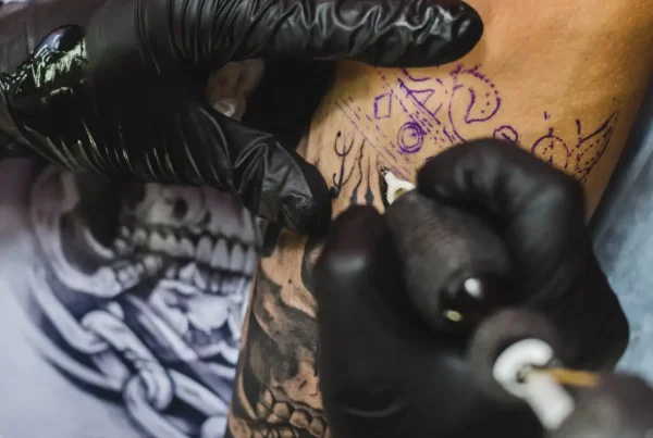 Problemas-piel-tatuaje