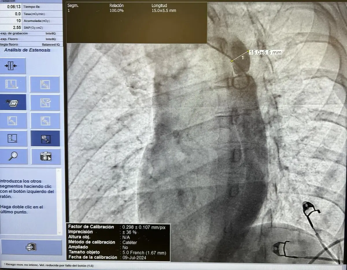 imagen del sistema Allia IGS Pulse de GE HealthCare