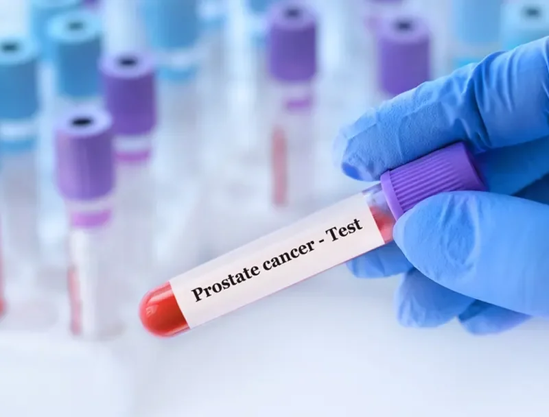 cribados para descifrar cáncer de próstata metastásico