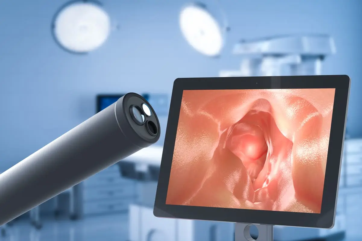 inteligencia artificial en Quirónsalud aplicadas en endoscopias en la policlínica Guipuzcoa