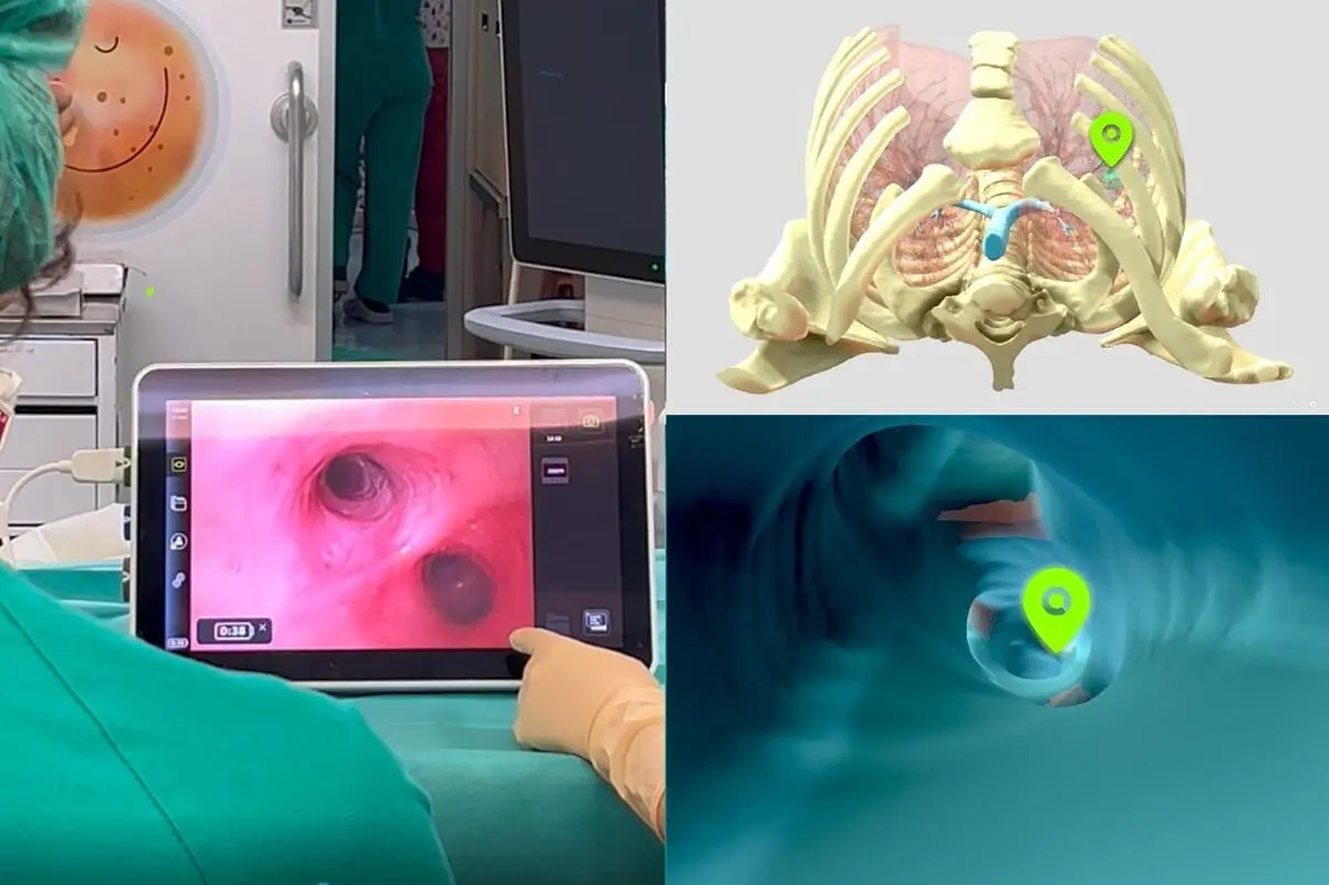 Como la innovación tecnológica mejora la cirugía pediátrica