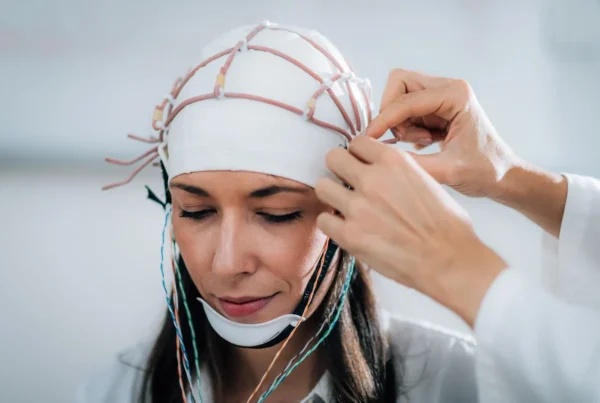 estimulación cerebral