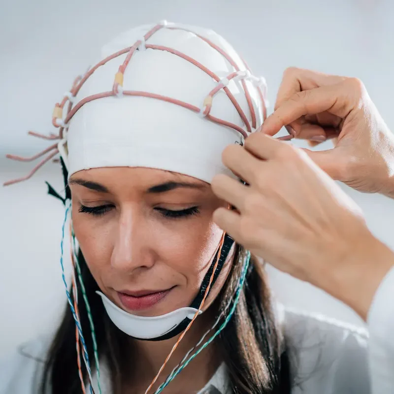 estimulación cerebral