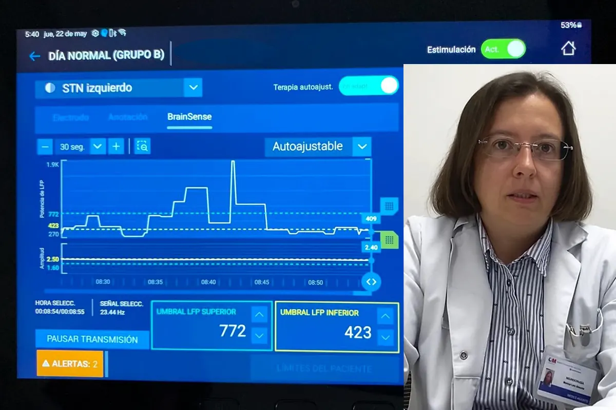 estimulación cerebral profunda adaptativa