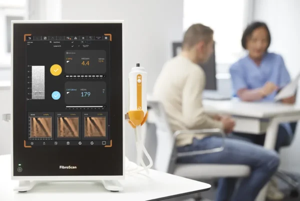 FibroScan para detectar higado graso