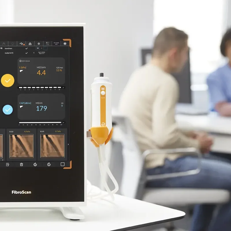 FibroScan para detectar higado graso