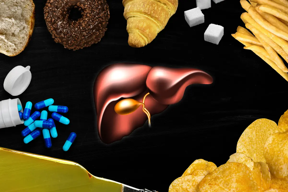 El estilo de vida influye en la aparición de la enfermedad del hígado graso