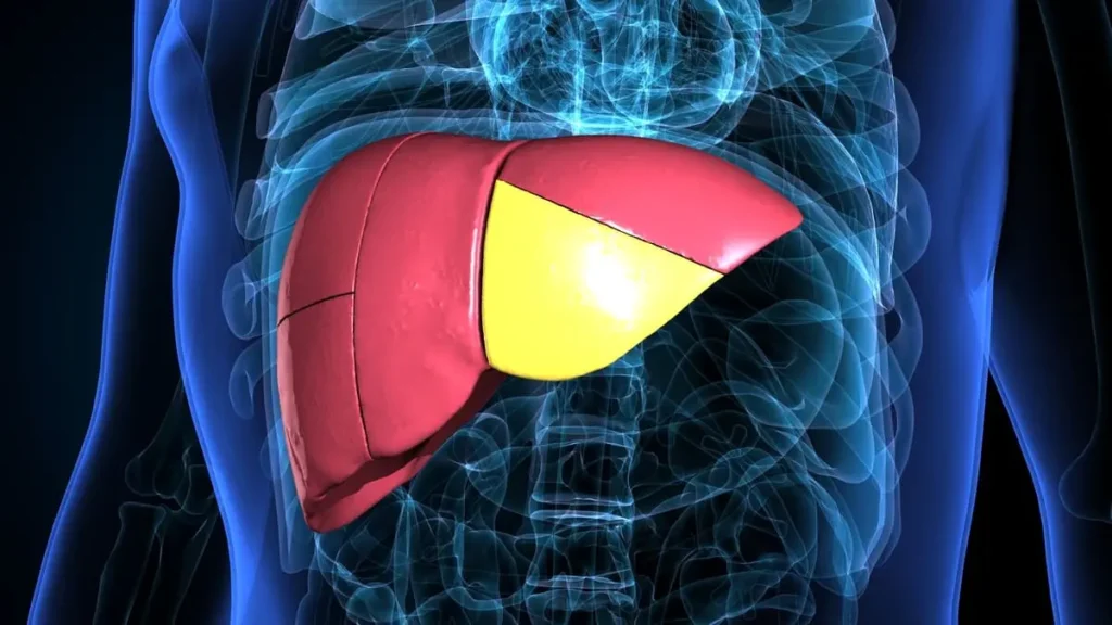Hígado graso enfermedad infradiagnosticada