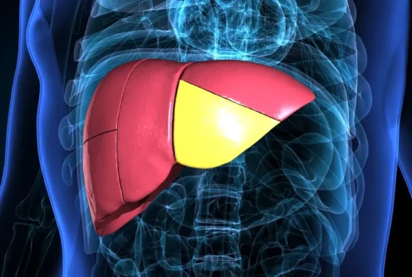 Hígado graso enfermedad infradiagnosticada