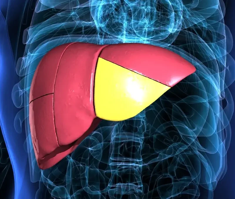 Hígado graso enfermedad infradiagnosticada
