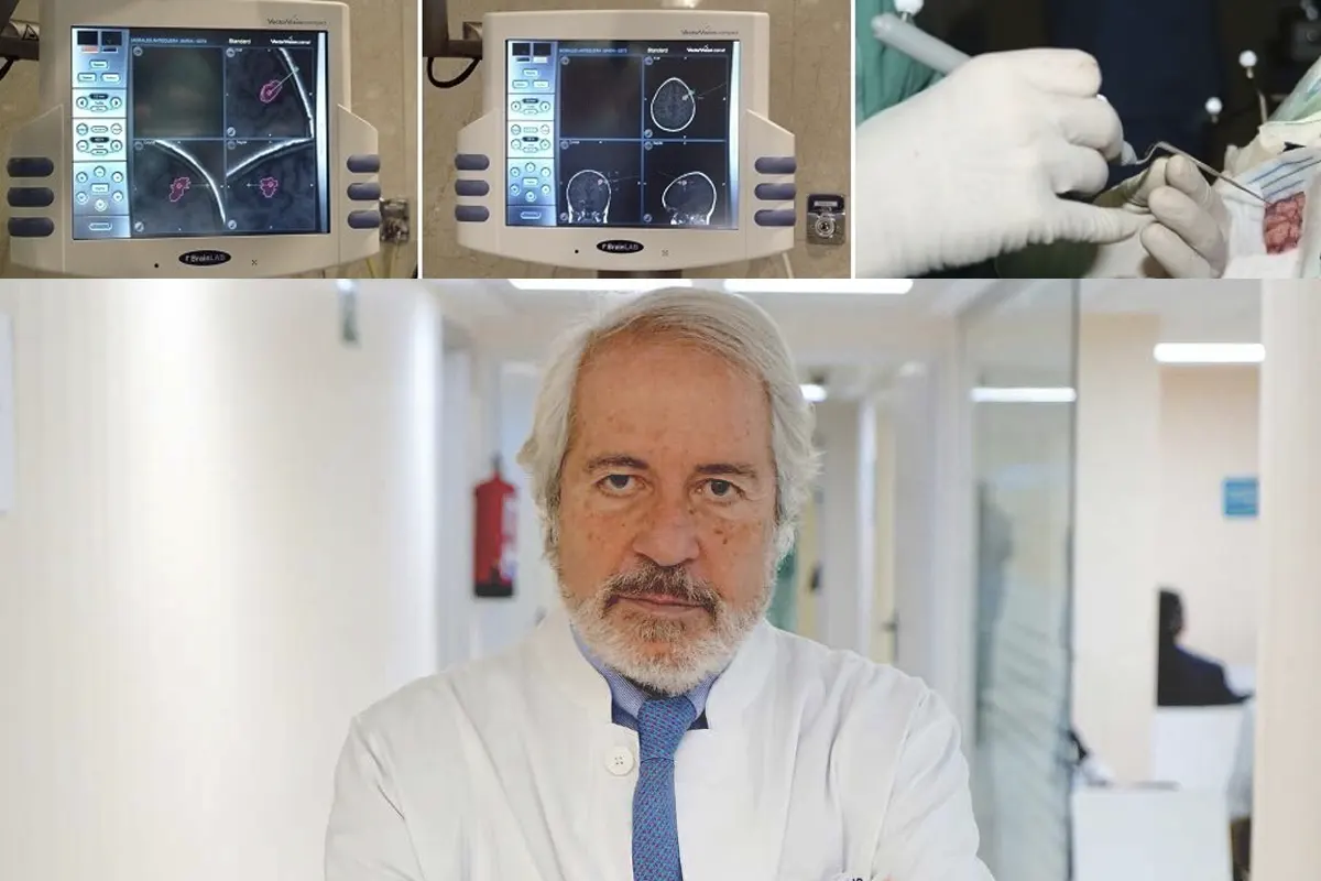 La neuronavegación es el mejor GPS de la cirugía moderna