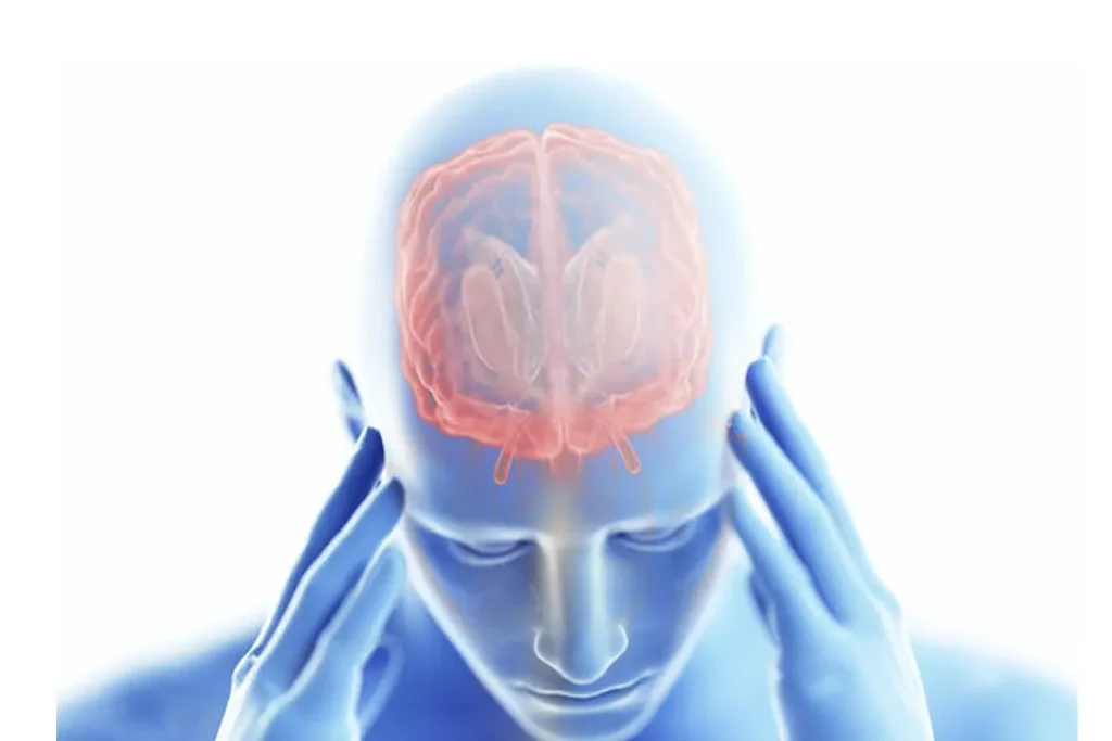 síntomas de la encefalitis