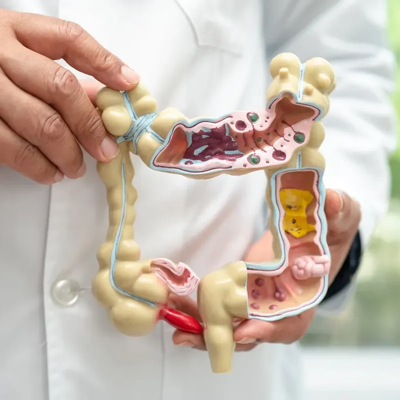 Dia Mundial contra el Cáncer de Colon