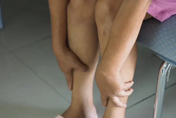 Tus piernas pueden estar pidiéndote una revisión vascular