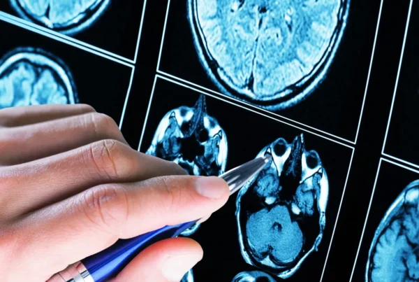 microcirugía tumores cerebrales