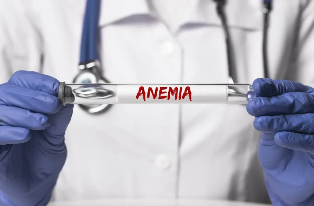 anemia cansancio frecuente