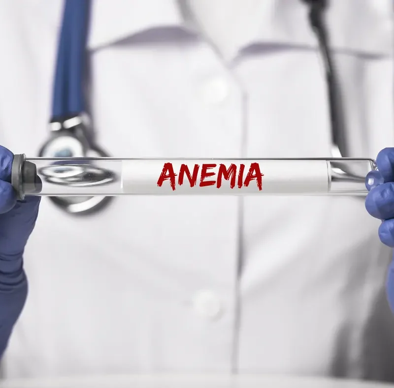 anemia cansancio frecuente