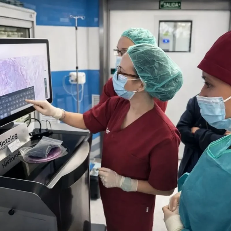 Histolog Scanner cirugías de cáncer de próstata