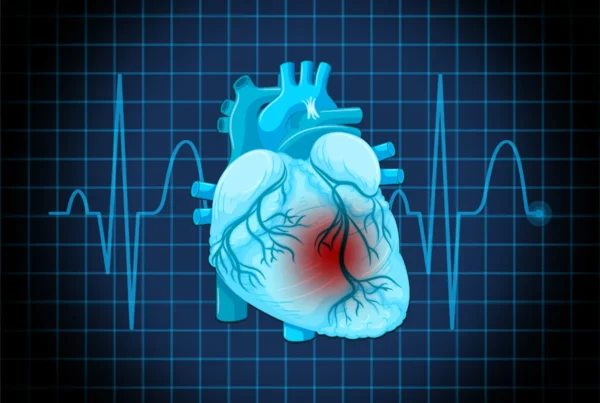 infarto y enfermedad cardiovascular
