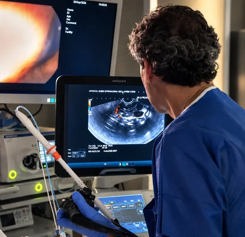 El Ruber Internacional lograr destruir un tumor en el páncreas